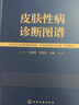 皮肤性病诊断图谱（精装、全彩图解、铜版纸） 实拍图