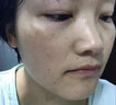 泊泉雅维c精华油vc液原液乙基醚花青素精华液组合水疗 1瓶装【100ml】 实拍图