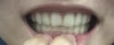 ZICCO牙齿矫正器隐形牙套矫正器儿童成人牙齿矫正防磨牙龅牙不齐地包天 定制1期上下(3期送动画) 实拍图