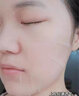 瑞美创瑞美创面部护理精华贴青春痘粉刺修护面膜调理肌肤修复皮肤屏障 面膜*(1盒装) 实拍图