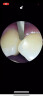 爱尔创超声波洁牙器洁牙器牙结石去除器超声波家用洁牙仪溶解牙垢清洁速效 陶瓷白 高颜派冲牙器 晒单实拍图