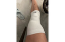 Reebok护膝运动跑步男膝盖保暖半月板髌骨膝盖护具篮球羽毛球登山护漆盖 实拍图