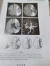 脑卒中神经影像学实例解析 实拍图