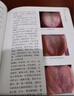 临证舌诊录 中医基础 实拍图