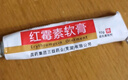 三益 红霉素软膏10g 化脓性皮肤溃烂感染痤疮yp 1盒装 实拍图