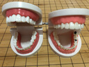 伯元堂【口腔教学】牙齿模型幼儿早教刷牙幼儿园教刷牙儿童宝宝口腔教学  (蛀牙与正常)1:1套装共2个 实拍图