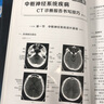影像报告书写一点通--CT诊断报告书写技巧 实拍图