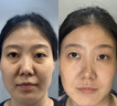 VLVEE美容仪脸部提拉紧致眼部按摩仪面部神器导出导入仪毛孔清洁器红蓝光家用生日礼物 【渐变粉】+硅胶洁面仪 六大模式/5重光波/3档温控 实拍图