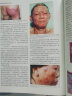 中国临床皮肤病学（套装上下册）（第2版） 实拍图
