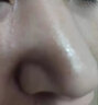 鼻炎特傚效专用贴药日本进口过敏性鼻窦炎鼻痒鼻塞不通气通鼻神器 一盒装 晒单实拍图