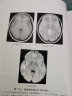 影像鉴别诊断一目了然系列--MRI鉴别诊断一点通（第三版） 实拍图