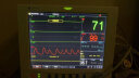 力康（Heal Force）医用多参数监护仪心电监测仪24持续监测病房测血压血氧体温脉率呼吸心率心电图机PC-9000B 实拍图