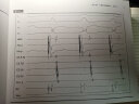 通过病例学习的临床心电生理学概念与要点：心腔内电图 实拍图