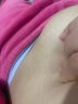妊娠纹修复产后去除消除霜生长纹肥胖纹去除淡化紧致肚皮医用凝胶 单盒装 晒单实拍图