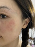修正敏感肌修复面霜脸部泛红红血丝修复角质层薄增厚激素红高原红保湿 修护三件套B【水+精华+霜】 实拍图