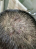 百多邦 莫匹罗星软膏2%*10g  脓疱病疖肿毛囊炎湿疹 中美史克 实拍图