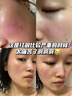 修正敏感肌修复面霜脸部泛红红血丝修复角质层薄增厚激素红高原红保湿 修护三件套B【水+精华+霜】 实拍图