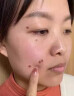 Newliann医用重组三型人源化胶原蛋白外用人表皮生长因子凝胶皮肤疤痕修复 实拍图