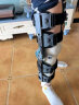 麦德威 medwe医用膝关节固定支具髌骨骨折护具膝盖半月板损伤护膝支架术后膝盖腿部骨折护具 实拍图