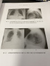 哈里森呼吸及危重症医学（原书第2版） 实拍图
