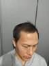 假发男 真发假发片 补发块  男士 补发真发头顶补发片 真发块短发 手织隐形补发块 帅气韩版 全真发 【20*22】全手织款成熟斜刘海 实拍图