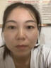 香蜂草左旋vc精华液 嫩滑肌细毛孔 左旋VC精华维C精华液 院线品质【共60粒】 实拍图