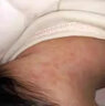 达儿文成人幼儿爽身露祛痱止痒婴儿去痱子专用痱子水儿童痱子粉热痱水 【热痱淹红】山茶油修护膏 实拍图
