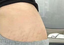 乐修妊娠纹修复产后去除100%消除紧致肚皮淡化生长肥胖纹预防修复霜 买2送1【一抹当天消】 实拍图