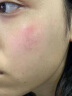焦博士日本复活草面膜晒后修复皮肤屏障受损泛红过敏脸部敏感肌补水20片 晒单实拍图