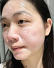 BKNE SKIN屏障修复平衡精华霜舒缓红血丝敏感肌脸部干红角质层薄高原红 一盒装 实拍图