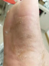 润芷堂脚气泡脚【泡喷抹】脚臭脚汗脱皮水泡型脚痒汗臭脚出汗丫脚气喷雾 轻度中度脚气选择【1套】 实拍图