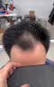 佰丝堂男士假发自然全头套真人发丝男假发套100%全真发假发男生微分碎盖 6-全真发【18*20仿肤递针】补发片 短发 实拍图