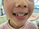 迪福伦 洁牙擦 牙齿橡皮擦去渍儿童牙菌斑牙黑渍牙齿清洁擦 （包装盒颜色随机发货） 实拍图