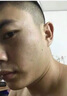 示博士尖锐湿疣扁平疣丝状疣专用疣体脱落可搭干扰素五氟尿嘧乳膏产品用 一套初期装【喷剂+一支乳膏】 可搭 5%咪奎喹莫特乳膏产品用 实拍图