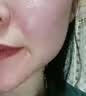 司帕美容院面部提升凝胶美容仪脸部提拉紧致皮肤初老皱纹射频美容仪 玻尿酸美容凝胶 实拍图