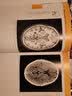 颅脑影像与临床神经解剖(MRI与CT图谱原著第4版)(精) 实拍图
