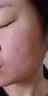 修正敏感肌护肤品红血丝修复角质层薄增厚脸部泛红过敏皮肤屏障舒缓霜 敏感肌肤护肤品D 实拍图