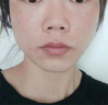 修正敏感肌护肤品红血丝修复角质层薄增厚脸部泛红过敏皮肤屏障舒缓霜 敏感肌肤护肤品D 实拍图