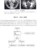 颅脑MRI诊断与鉴别诊断（第2版） 晒单实拍图