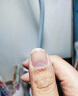 Dr.JYS甲卫士抑菌液灰指甲护理液增厚发黄变空专用山药监备特傚液 实拍图