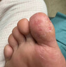 艳锦堂脚气泡脚中药包除i脚气脚臭脚汗止痒脚痒脱皮抑菌中草足浴泡脚包 两袋钱发3袋/90小包【周期装】 实拍图