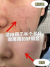 透真b5水杨酸清洁面膜收缩毛孔去黑头粉刺闭口涂抹泥膜补水保湿 实拍图