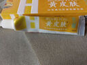 黄皮肤乳膏江西报恩堂神霸软膏成人皮肤护理外用抑菌软膏15g2盒装 实拍图