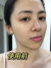 ROSIEN澳洲进口收缩毛孔精华液修复毛孔粗大细致去粉刺闭口祛痘印男女士 毛孔没了 30ml/瓶 实拍图