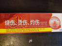 葵花烫伤膏烧伤膏开水热油烧烫伤湿润软膏抑菌凝胶疤痕肿创伤消肿 【消肿止痛】葵花医用生物创伤敷料 实拍图