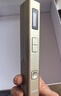 SIGMA希格玛308nm白癜风治疗仪银屑病光疗家用纳米紫外线医用同源 60强度308驭光棒15X15mm插电aFD 实拍图