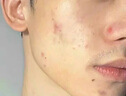 CJ氨基酸净澈洗面奶男士专用竹炭控油深层清洁面油橄榄叶净官方正品 【一支装】洗面奶100g 实拍图