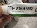 丽芙甲硝唑凝胶30g+阿达帕林凝胶35g甲硝锉凝胶祛痘印修复淡化痘印痘坑修复药膏 实拍图