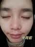 康佳（KONKA）可视化黑头仪黑头吸出器吸黑头清理神器美容仪洁面仪面部毛孔粉刺清洁仪器生日礼物送女友老婆实用 浅绿色-高清可视充电款+清黑头三件套+3种吸头 实拍图