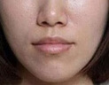 TANZI院线级810拉杆箱脱毛仪冰点激光脱毛光子嫩肤爆款家用美容院仪器 升级款【双风扇】黑色 十靶条 实拍图